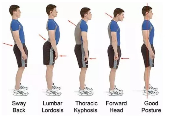 What Is Posture Definition